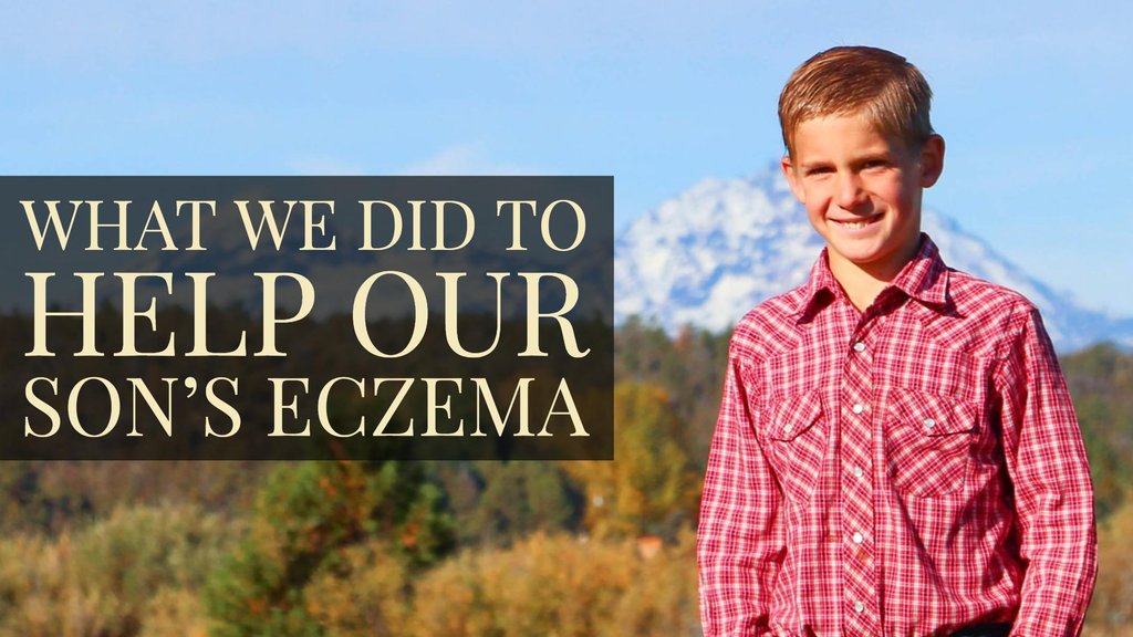What We Did to Help Our Son’s Eczema